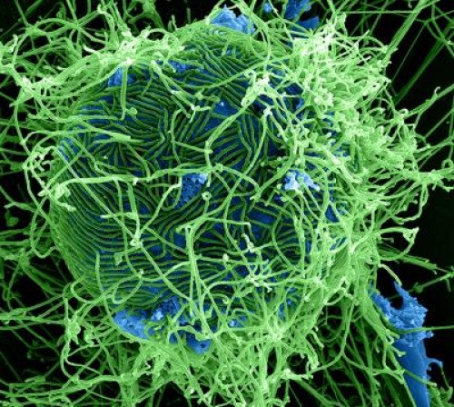 virus-ebola-180914 virus ebola