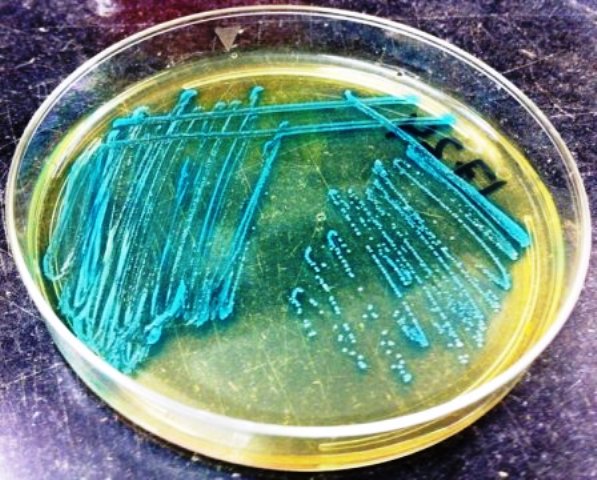 Listeria Monocytogenes