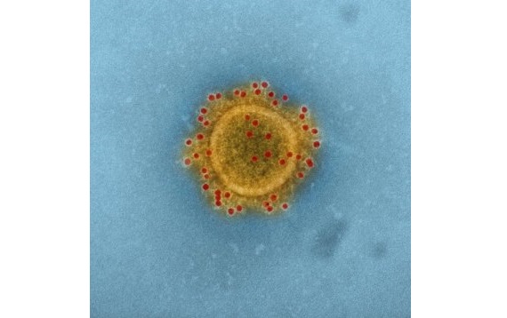 virus MERS