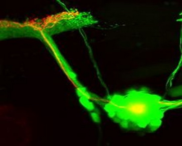 sel saraf, ikan zebra, protein aktif cahaya